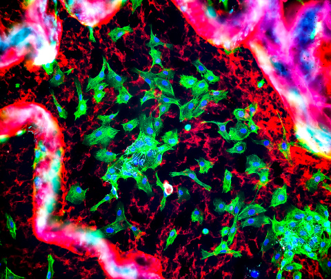 Pig liver tissue scaffold