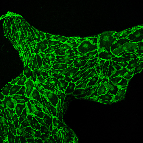 Human lymphatic endothelial cells