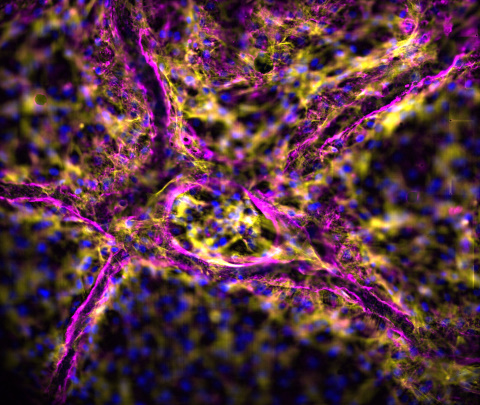 Decellularized porcine liver scaffold